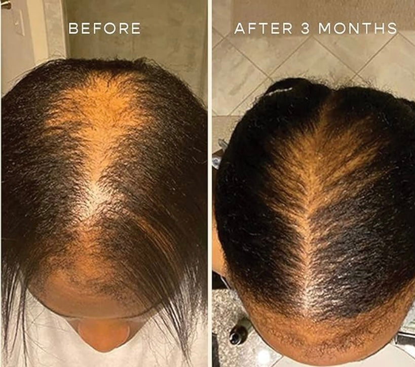 Hair Growth Oil